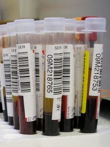 Qui tam lawsuit blood tests